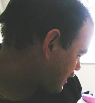 The Asshole, Darren Wiblin